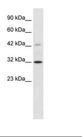 VDAC1 / PORIN Antibody - HepG2 Cell Lysate.  This image was taken for the unconjugated form of this product. Other forms have not been tested.
