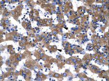VDAC1 / PORIN Antibody - VDAC1 antibody ARP35122_T100-NP_003365-VDAC1 (voltage-dependent anion channel 1) Antibody was used in IHC to stain formalin-fixed, paraffin-embedded human liver.  This image was taken for the unconjugated form of this product. Other forms have not been tested.