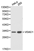VDAC1 / PORIN Antibody - Western blot of VDAC1 pAb in extracts from Hela and 293 cells.