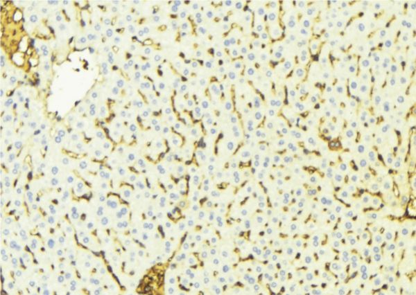 VDAC1 / PORIN Antibody - 1:100 staining mouse liver tissue by IHC-P. The sample was formaldehyde fixed and a heat mediated antigen retrieval step in citrate buffer was performed. The sample was then blocked and incubated with the antibody for 1.5 hours at 22°C. An HRP conjugated goat anti-rabbit antibody was used as the secondary.
