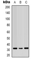 VDAC1 / PORIN Antibody - Western blot analysis of PORIN expression in Jurkat (A); HeLa (B); A431 (C) whole cell lysates.