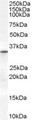 VDAC2 Antibody - Antibody (0.3 ug/ml) staining of Human Heart lysate (35 ug protein in RIPA buffer). Primary incubation was 1 hour. Detected by chemiluminescence.