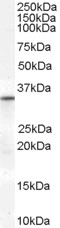 VDAC2 Antibody - Antibody (0.3 ug/ml) staining of Human Heart lysate (35 ug protein in RIPA buffer). Primary incubation was 1 hour. Detected by chemiluminescence.