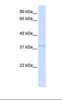VDAC2 Antibody - 293T cell lysate. Antibody concentration: 1.0 ug/ml. Gel concentration: 12%.  This image was taken for the unconjugated form of this product. Other forms have not been tested.