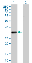 VDAC2 Antibody - Western Blot analysis of VDAC2 expression in transfected 293T cell line by VDAC2 monoclonal antibody (M01), clone 3D2.Lane 1: VDAC2 transfected lysate(31.6 KDa).Lane 2: Non-transfected lysate.