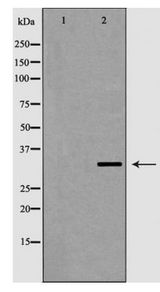 VDAC2 Antibody - Western blot of VDAC2 expression in HeLa