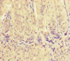 VDAC2 Antibody - Immunohistochemistry of paraffin-embedded human adrenal gland tissue at dilution of 1:100