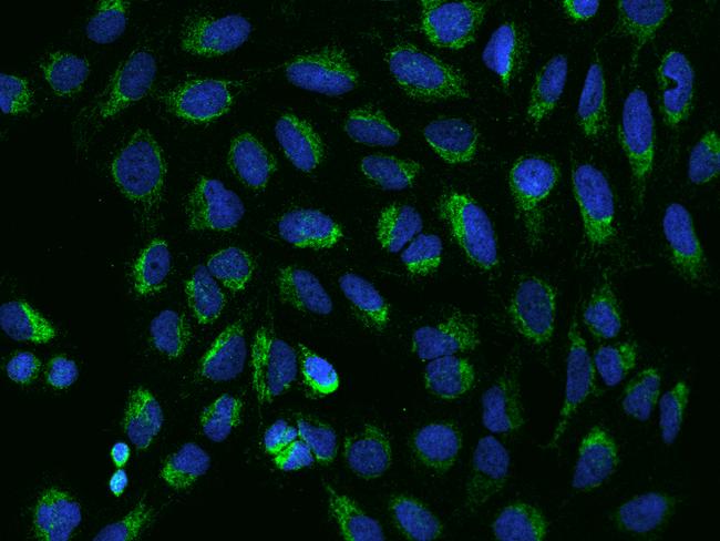VDAC2 Antibody - Immunofluorescence staining of VDAC2 in U2OS cells. Cells were fixed with 4% PFA, permeabilzed with 0.1% Triton X-100 in PBS, blocked with 10% serum, and incubated with rabbit anti-Human VDAC2 polyclonal antibody (dilution ratio 1:200) at 4°C overnight. Then cells were stained with the Alexa Fluor 488-conjugated Goat Anti-rabbit IgG secondary antibody (green) and counterstained with DAPI (blue). Positive staining was localized to Cytoplasm.
