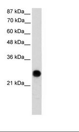 VDAC2 Antibody - Transfected 293T Cell Lysate.  This image was taken for the unconjugated form of this product. Other forms have not been tested.