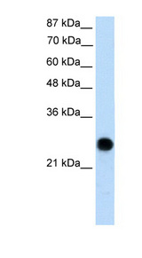 VDAC2 Antibody - VDAC2 antibody Western blot of Transfected 293T cell lysate. This image was taken for the unconjugated form of this product. Other forms have not been tested.