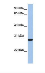 VDAC3 Antibody - Fetal heart lysate. Antibody concentration: 1.0 ug/ml. Gel concentration: 12%.  This image was taken for the unconjugated form of this product. Other forms have not been tested.