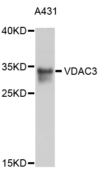 VDAC3 Antibody - Western blot analysis of extracts of A-431 cells, using VDAC3 antibody at 1:1000 dilution. The secondary antibody used was an HRP Goat Anti-Rabbit IgG (H+L) at 1:10000 dilution. Lysates were loaded 25ug per lane and 3% nonfat dry milk in TBST was used for blocking. An ECL Kit was used for detection and the exposure time was 5s.