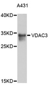 VDAC3 Antibody - Western blot analysis of extracts of A-431 cells, using VDAC3 antibody at 1:1000 dilution. The secondary antibody used was an HRP Goat Anti-Rabbit IgG (H+L) at 1:10000 dilution. Lysates were loaded 25ug per lane and 3% nonfat dry milk in TBST was used for blocking. An ECL Kit was used for detection and the exposure time was 5s.
