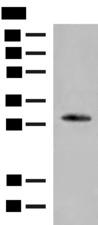 VDAC3 Antibody - Western blot analysis of Human left thymus tissue lysate  using VDAC3 Polyclonal Antibody at dilution of 1:200