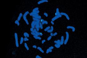Product - Single copy DNA probe to the Downs region of chromosome 21 using FITC-labeled antibody (green) and mounted in VECTASHIELD® Mounting Medium with DAPI (blue) - Photo courtesy of Cytocell Ltd.