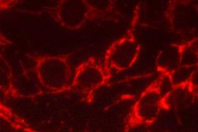 Product - C6 rat glioma cells: Antibody to mitochondria localized with Alexa 555 labeled secondary antibody. Mounted in VECTASHIELD® HardSet Mounting Medium. Image provided courtesy of Chandler Fulton and Jennifer Stella, Department of Biology, Brandeis University.