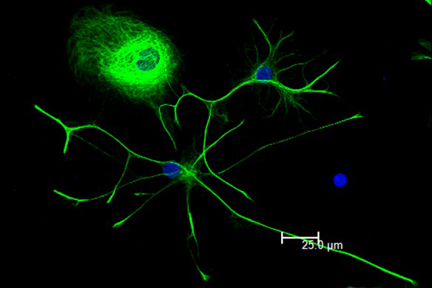 Product - Astrocytes: Stained for GFAP and detected with DyLight® 488 labeled secondary antibody. Mounted in VECTASHIELD® HardSet Mounting Medium with DAPI. Image courtesy of Dr Emma East, Department of Life Sciences, The Open University, U.K.