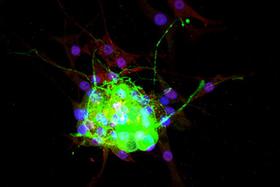 Product - Dorsal root ganglia cells (neurons and satellite glia) - double label. BIII tubulin, DyLight® 488 labeled secondary antibody (green). S100, DyLight® 594 labeled secondary antibody (red). Mounted in VECTASHIELD® HardSet Mounting Medium with DAPI.