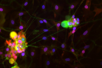Product - Dorsal root ganglia cells (neurons and satellite glia) - double label. BIII tubulin, DyLight® 488 labeled secondary antibody (green). S100, DyLight® 594 labeled secondary antibody (red). Mounted in VECTASHIELD® HardSet Mounting Medium with DAPI.