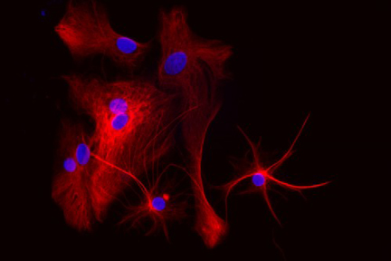 Product - Astrocytes: Stained for GFAP and detected with DyLight® 594 labeled secondary antibody. Mounted in VECTASHIELD® HardSet Mounting Medium with DAPI. Image courtesy of Dr Emma East, Department of Life Sciences, The Open University, U.K.