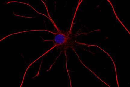 Product - Astrocytes: Stained for GFAP and detected with DyLight® 549 labeled secondary antibody. Mounted in VECTASHIELD® HardSet Mounting Medium with DAPI. Image courtesy of Dr Emma East, Department of Life Sciences, The Open University, U.K.