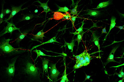 Product - Dorsal root ganglia cells (neurons and satellite glia) - double label. BIII tubulin, DyLight® 549 labeled secondary antibody (red). S100, DyLight® 488 labeled secondary antibody (green). Mounted in VECTASHIELD® HardSet Mounting Medium with DAPI.