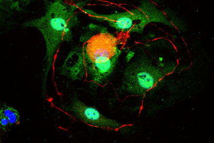 Product - Dorsal root ganglia cells (neurons and satellite glia) - double label. BIII tubulin, DyLight® 594 labeled secondary antibody (red). S100, DyLight® 488 labeled secondary antibody (green). Mounted in VECTASHIELD® HardSet Mounting Medium with DAPI. 