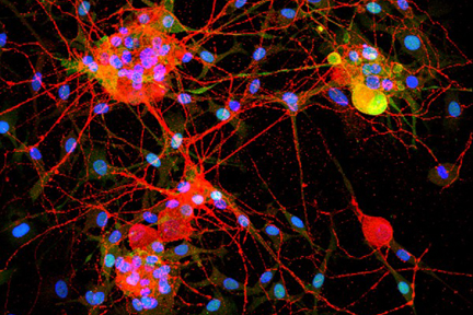 Product - Dorsal root ganglia cells (neurons and satellite glia) - double label. BIII tubulin, DyLight® 594 labeled secondary antibody (red). S100, DyLight® 488 labeled secondary antibody (green). Mounted in VECTASHIELD® HardSet Mounting Medium with DAPI. 