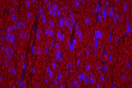Product - Colon: Desmin (m), Biotinylated Horse anti-mouse IgG, Texas Red®Avidin DCS (red). Mounted in VECTASHIELD® HardSet Mounting Medium with DAPI.