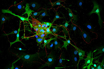 Product - Dorsal root ganglia cells (neurons and satellite glia) - double label. BIII tubulin, DyLight® 549 labeled secondary antibody (red). S100, DyLight® 488 labeled secondary antibody (green). Mounted in VECTASHIELD® HardSet Mounting Medium with DAPI. 