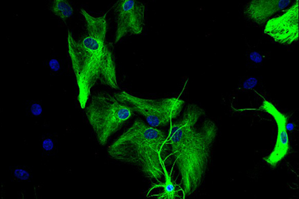 Product - Astrocytes: Stained for GFAP and detected with DyLight® 488 labeled secondary antibody. Mounted in VECTASHIELD® HardSet Mounting Medium with DAPI. Image courtesy of Dr Emma East, Department of Life Sciences, The Open University, U.K.