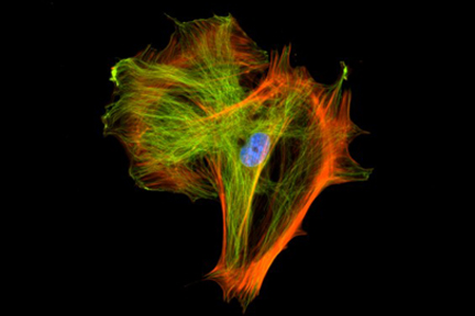 Product - Mouse embryonic fibroblast stained with mouse anti-tubulin followed by fluorescein horse anti-mouse IgG and mounted in VECTASHIELD® HardSet Mounting Medium with DAPI and TRITC-Phalloidin.