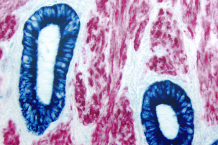 Product - Uterus (double label): Epithelium (blue, Vector® Blue), muscle (red, Vector® Red).
