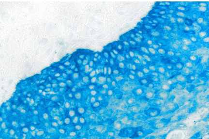 Product - Tonsil: Cytokeratin (AE1/AE3 (m), ImmPRESS-AP Reagent, Vector Blue™ AP Substrate (blue).