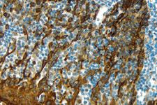 Tonsil: Cytokeratin (m), ImmPRESS™ Anti-Mouse Ig Kit, ImmPACT™ DAB (brown) substrate. Hematoxylin (blue) counterstain.