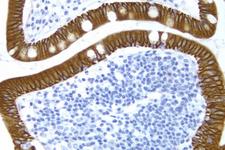 Small Bowel: Cytokeratin 8/18 (m), ImmPRESS™ Anti-Mouse Ig Kit, DAB Substrate Kit (brown), Hematoxylin QS (blue).