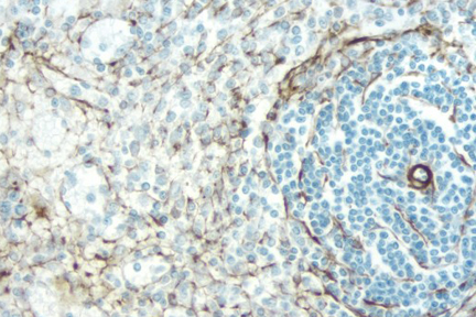 Product - Rat Spleen: Desmin (m), ImmPRESS™ Anti-Mouse Ig Kit (Rat Adsorbed), DAB (brown) Substrate Kit. Hematoxylin QS (blue) counterstain.