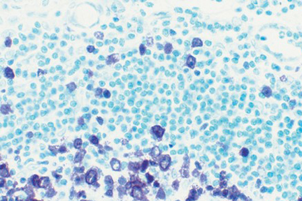 Product - Tonsil section showing specific cell staining (purple, Vector® VIP) with Vector® Methyl Green (green) counterstain.