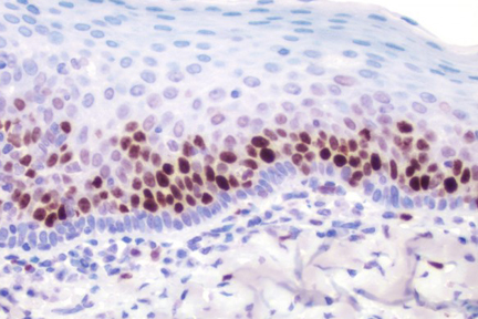 Product - Tonsil: Ki67 antigen detected using ImmPRESS™ Universal Reagent and Vector® NovaRED® (red) substrate. Hematoxylin QS (blue) counterstain.