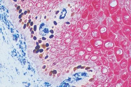 Product - Epithelium: Proliferating cells (brown, DAB), endothelial cells (blue, Vector Blue™ substrate), epithelial cells (red, Vector Red™ Substrate).
