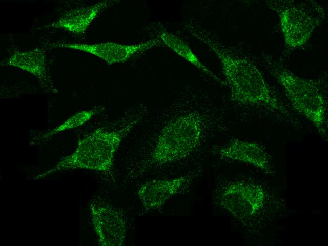 VEGF 121 Antibody - Immunofluorescence staining of VEGF121 in HeLa cells. Cells were fixed with 4% PFA, permeabilzed with 0.3% Triton X-100 in PBS, blocked with 10% serum, and incubated with rabbit anti-Human VEGF121 polyclonal antibody (dilution ratio 1:1000) at 4°C overnight. Then cells were stained with the Alexa Fluor 488-conjugated Goat Anti-rabbit IgG secondary antibody (green). Positive staining was localized to cytoplasm.