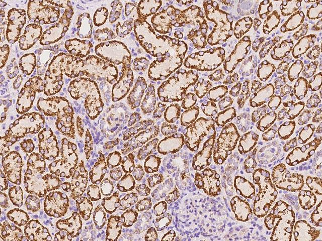 VEGF 121 Antibody - Immunochemical staining of human VEGF121 in human kidney with rabbit polyclonal antibody at 1:500 dilution, formalin-fixed paraffin embedded sections.