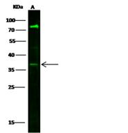 VEGF 121 Antibody - Anti-VEGF121 rabbit polyclonal antibody at 1:500 dilution. Lane A: Jurkat Whole Cell Lysate. Lysates/proteins at 30 ug per lane. Secondary: Goat Anti-Rabbit IgG H&L (Dylight800) at 1/10000 dilution. Developed using the Odyssey technique. Performed under reducing conditions. Predicted band size: 27 kDa. Observed band size: 37 kDa. (We are unsure as to the identity of these extra bands.)
