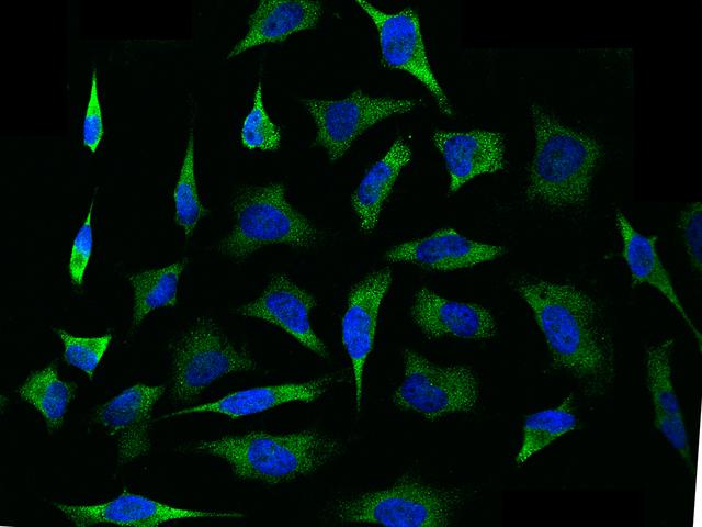 VEGF 165 Antibody - Immunofluorescence staining of VEGF165 in HeLa cells. Cells were fixed with 4% PFA, permeabilzed with 0.1% Triton X-100 in PBS, blocked with 10% serum, and incubated with rabbit anti-Human VEGF165 polyclonal antibody (dilution ratio 1:1000) at 4°C overnight. Then cells were stained with the Alexa Fluor 488-conjugated Goat Anti-rabbit IgG secondary antibody (green) and counterstained with DAPI (blue). Positive staining was localized to cytoplasm.