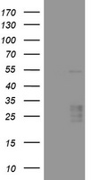 VEGFA / VEGF Antibody - HEK293T cells were transfected with the pCMV6-ENTRY control (Left lane) or pCMV6-ENTRY VEGFA (Right lane) cDNA for 48 hrs and lysed. Equivalent amounts of cell lysates (5 ug per lane) were separated by SDS-PAGE and immunoblotted with anti-VEGFA.