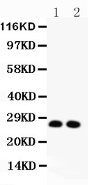 VEGFA / VEGF Antibody - VEGF antibody Western blot. All lanes: Anti-VEGF at 0.5 ug/ml. Lane 1: Rat Thymus Tissue Lysate at 40 ug. Lane 2: Rat Brain Tissue Lysate at 40 ug. Predicted band size: 27 kD. Observed band size: 27 kD.