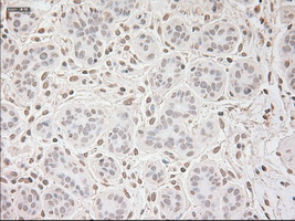 VEGFA / VEGF Antibody - IHC of paraffin-embedded breast tissue using anti-VEGF mouse monoclonal antibody. (Dilution 1:50).