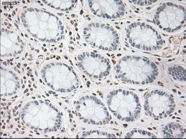 VEGFA / VEGF Antibody - IHC of paraffin-embedded colon tissue using anti-VEGF mouse monoclonal antibody. (Dilution 1:50).