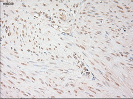 VEGFA / VEGF Antibody - IHC of paraffin-embedded endometrium tissue using anti-VEGF mouse monoclonal antibody. (Dilution 1:50).