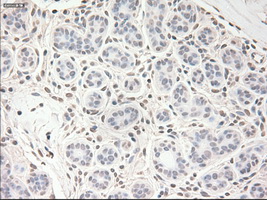 VEGFA / VEGF Antibody - Immunohistochemical staining of paraffin-embedded breast tissue using anti-VEGF mouse monoclonal antibody. (Dilution 1:50).